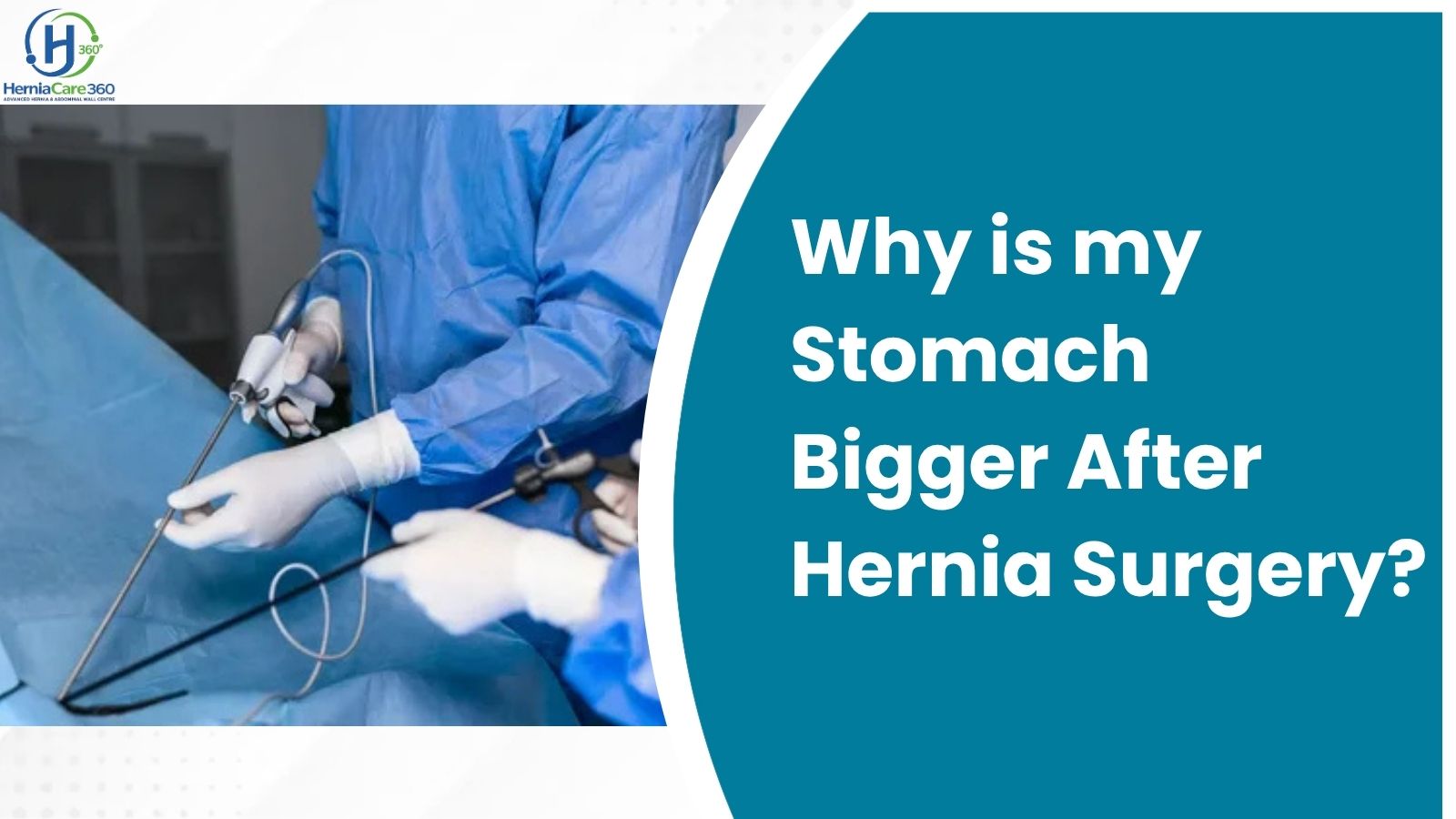 Why is my Stomach Bigger After Hernia Surgery?