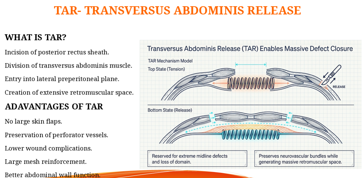 Transversus Abdominis Release (TAR) diagram